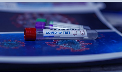 HOSTELERIA :TEST MASIVOS Y GRATUITOS , ES UNA NECESIDAD